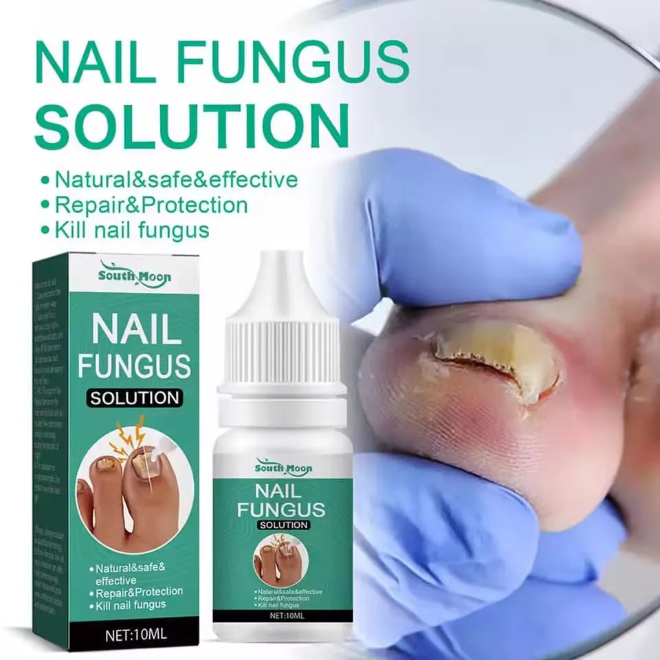 Nail Fungus Treatment Stop Fungal Growth Effective Fingernail 30ml
