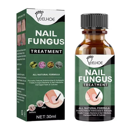 Nail Fungus Treatment Stop Fungal Growth Effective Fingernail 30ml