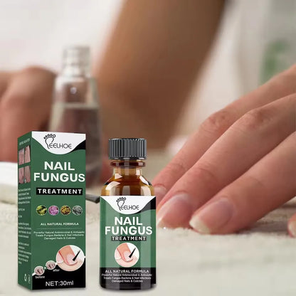 Nail Fungus Treatment Stop Fungal Growth Effective Fingernail 30ml