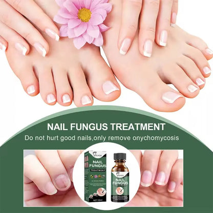 Nail Fungus Treatment Stop Fungal Growth Effective Fingernail 30ml